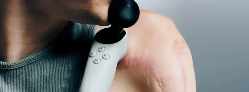 Xbox - Accesibilidad